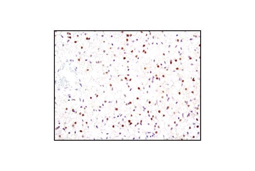 Immunohistochemistry Image 2: PPAR gamma (C26H12) Rabbit Monoclonal Antibody (BSA and Azide Free)