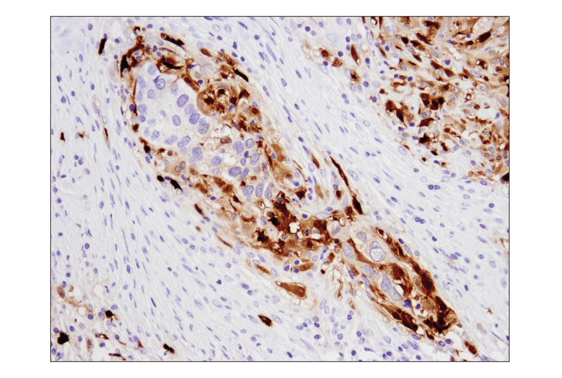 Immunohistochemistry Image 4: S100A9 (D5O6O) Rabbit Monoclonal Antibody (BSA and Azide Free)