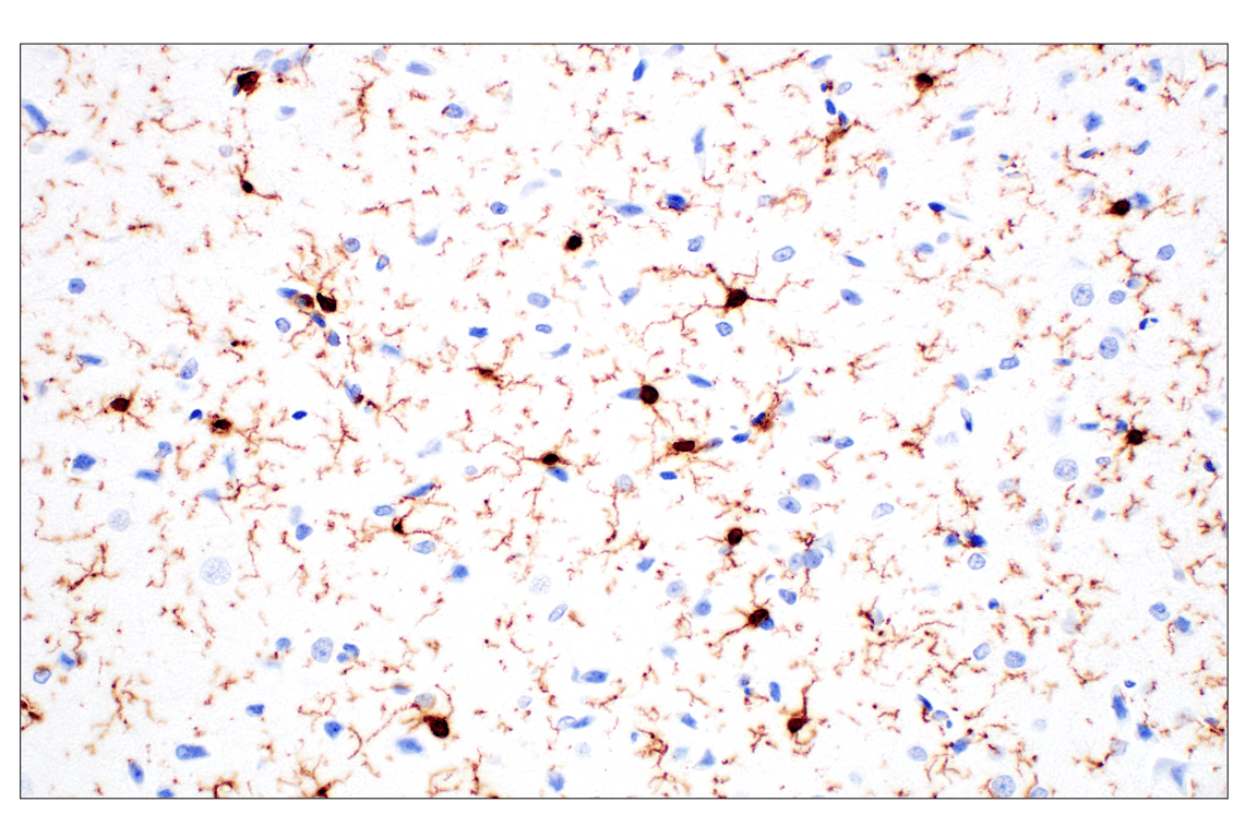 Immunohistochemistry Image 12: Iba1/AIF-1 (E4O4W) Rabbit Monoclonal Antibody (BSA and Azide Free)