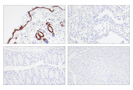 Immunohistochemistry Image 3: Keratin 5 (E2T4B) Rabbit Monoclonal Antibody
