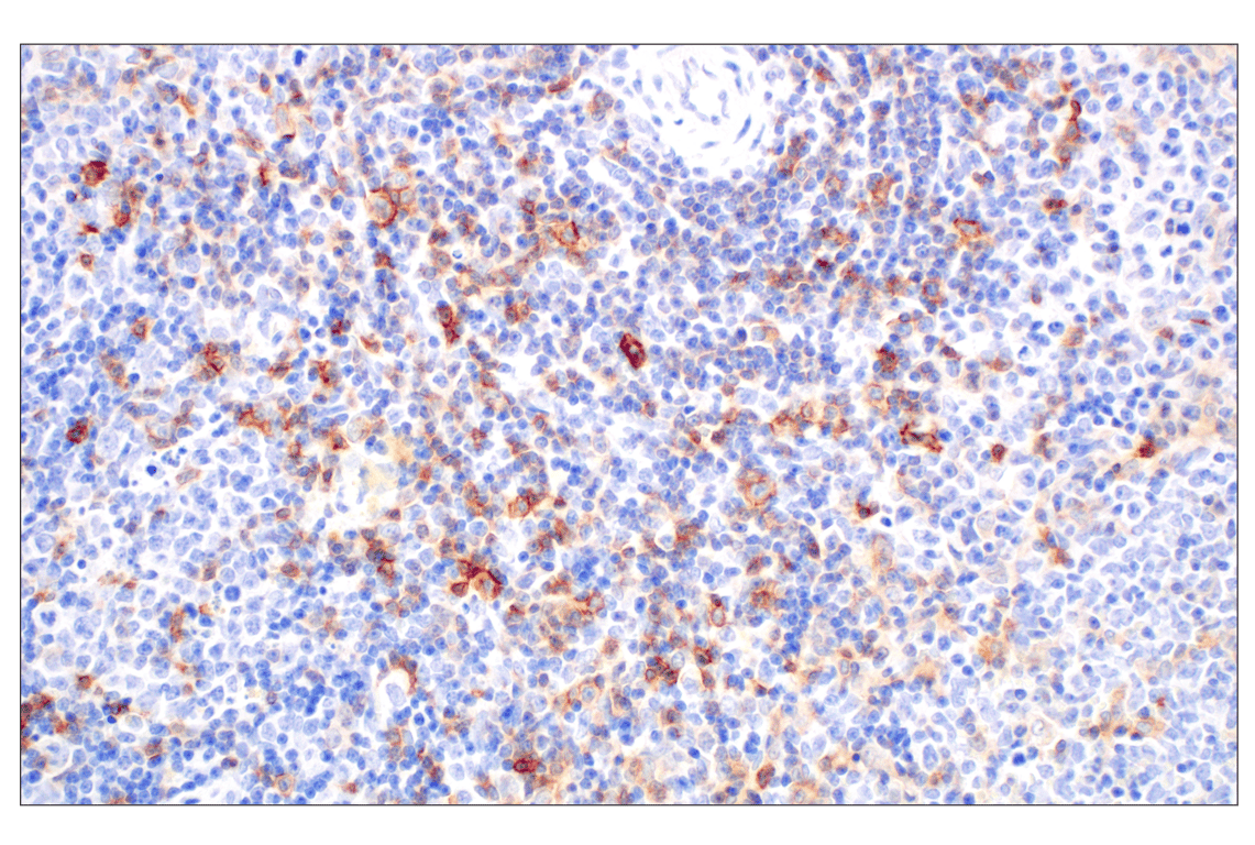 Immunohistochemistry Image 6: ICOS (E5F7E) Rabbit Monoclonal Antibody