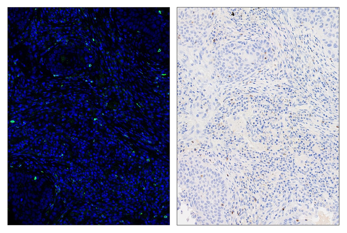 Immunohistochemistry Image 6: LAG3 (D2G4O) & CO-0026-647 SignalStar<sup>®</sup> Oligo-Antibody Pair