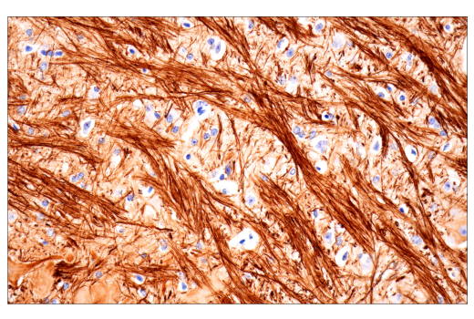 Immunohistochemistry Image 2: Neurofilament-H (E7Z7G) Rabbit Monoclonal Antibody (BSA and Azide Free)