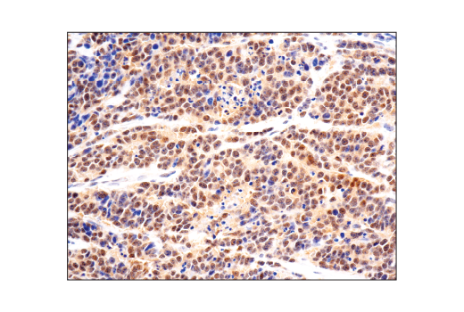 Immunohistochemistry Image 1: SMAD4 (D3R4N) Rabbit Monoclonal Antibody