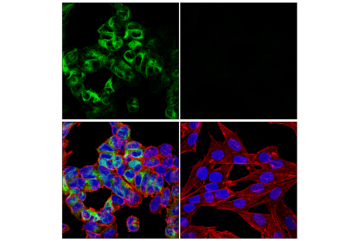 Immunofluorescence Image 1: Neurofilament-H (E7Z7G) Rabbit Monoclonal Antibody