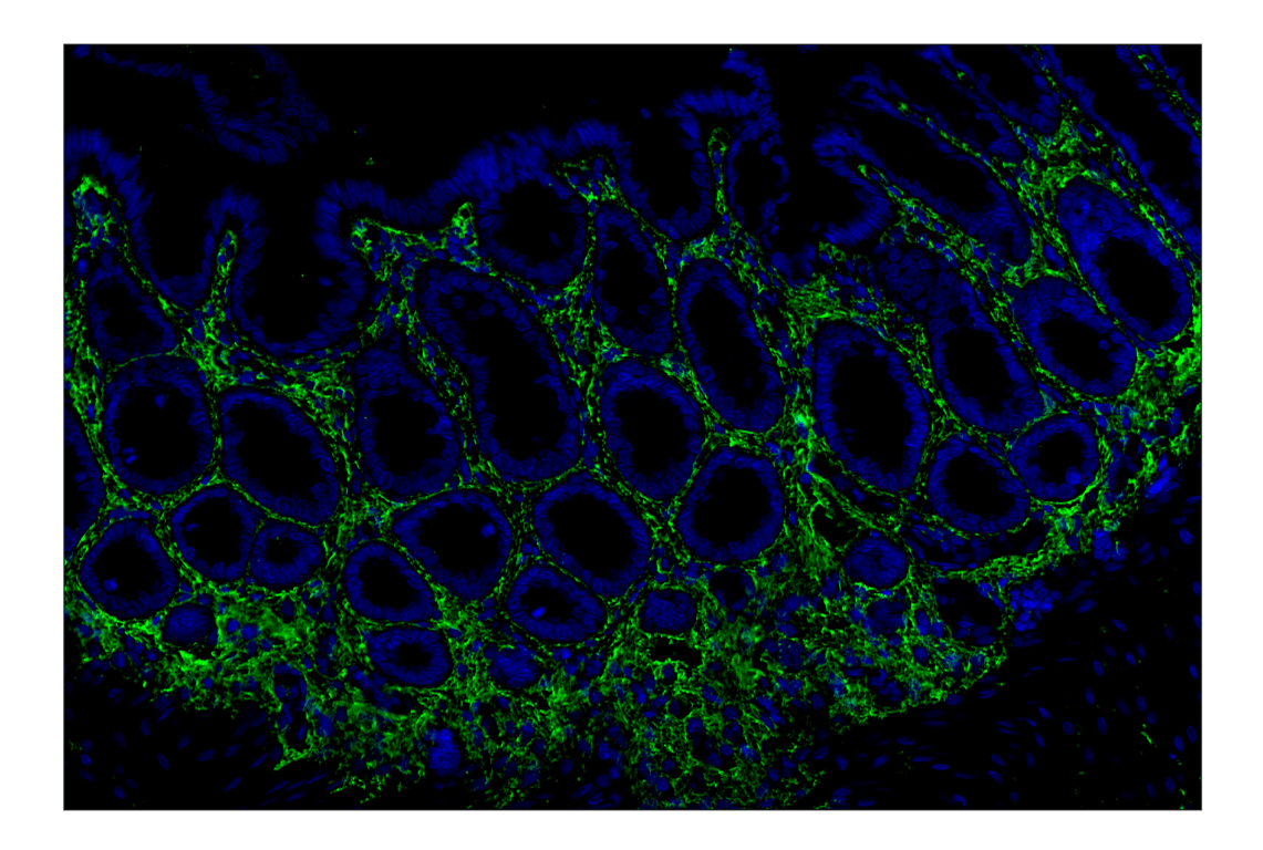 Immunohistochemistry Image 11: Hyaluronan Complete Tissue Staining Kit (Alexa Fluor<sup>®</sup> 488)