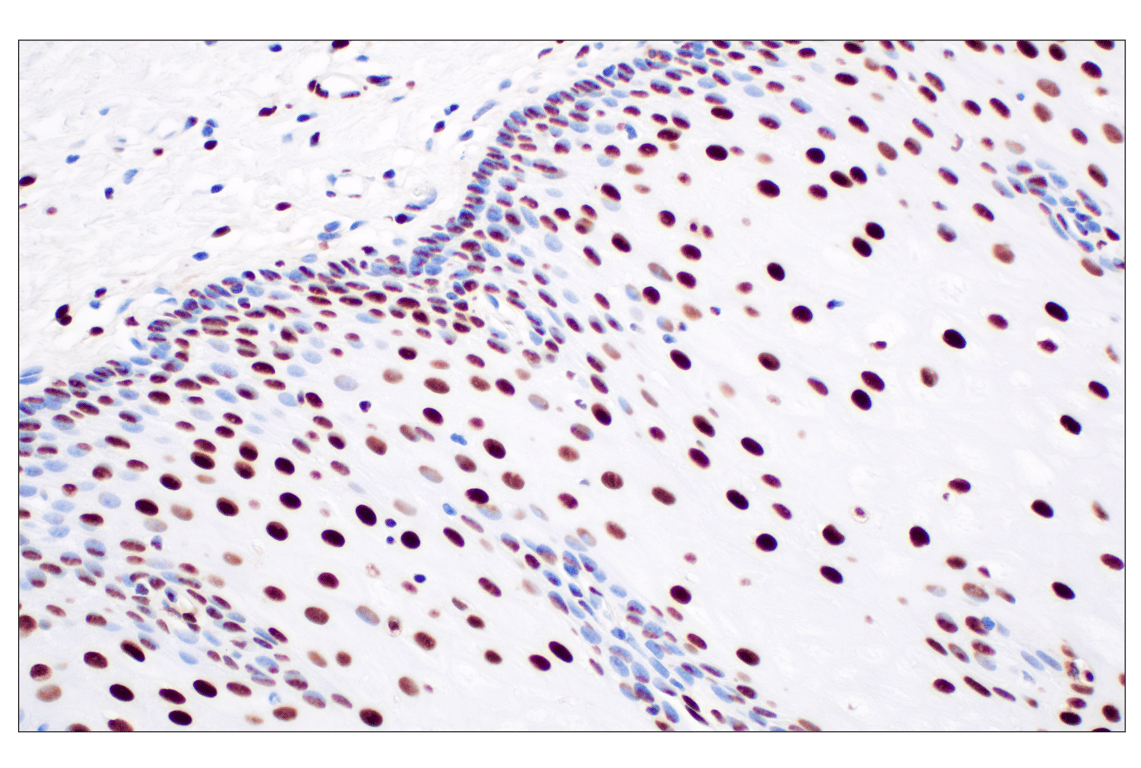 Immunohistochemistry Image 4: NPM1 (E7W4P) Rabbit Monoclonal Antibody (BSA and Azide Free)