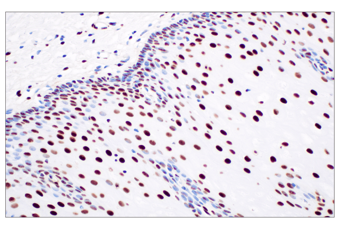 Immunohistochemistry Image 4: NPM1 (E7W4P) Rabbit mAb (BSA and Azide Free)
