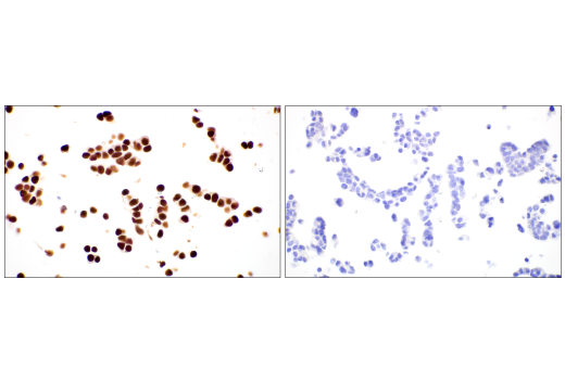 Immunohistochemistry Image 9: POU2F3 (E5N2D) Rabbit Monoclonal Antibody