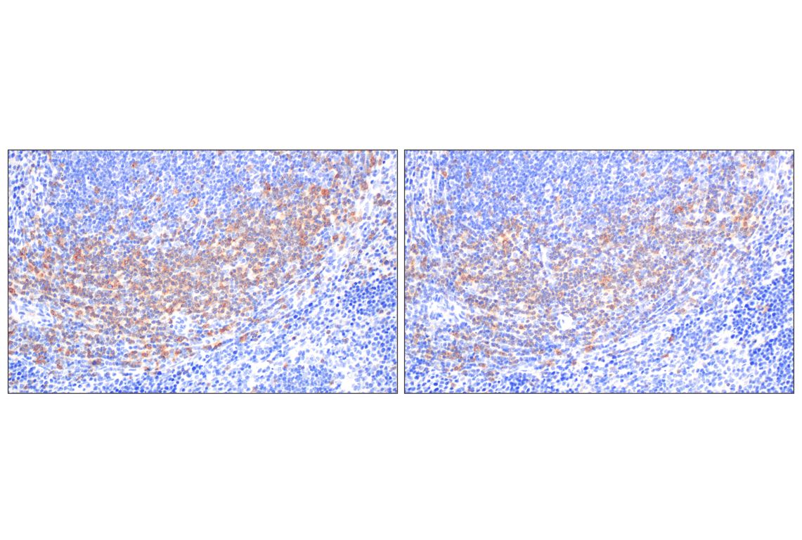 Immunohistochemistry Image 6: CD27 (F3R2V) Rabbit Monoclonal Antibody