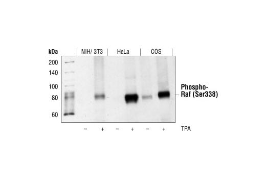 undefined Image 8: Raf Family Antibody Sampler Kit