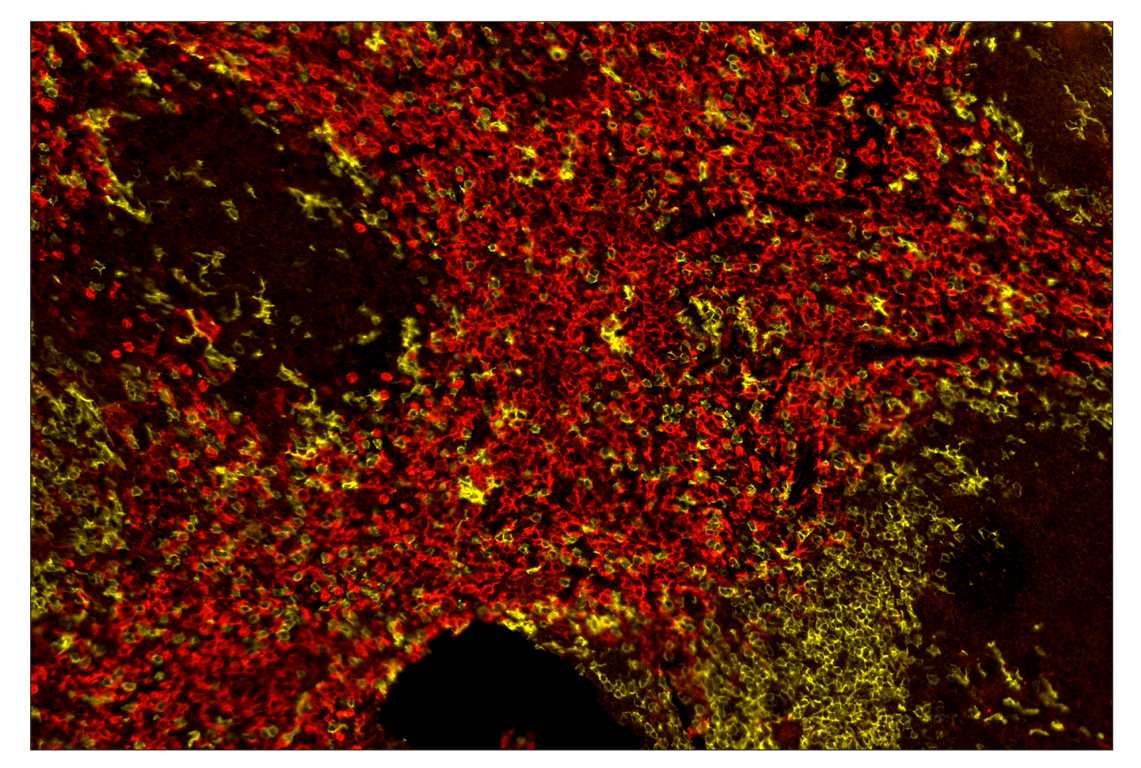 Immunohistochemistry Image 1: CD8α (D4W2Z) & CO-0040-647 SignalStar<sup>™</sup> Oligo-Antibody Pair