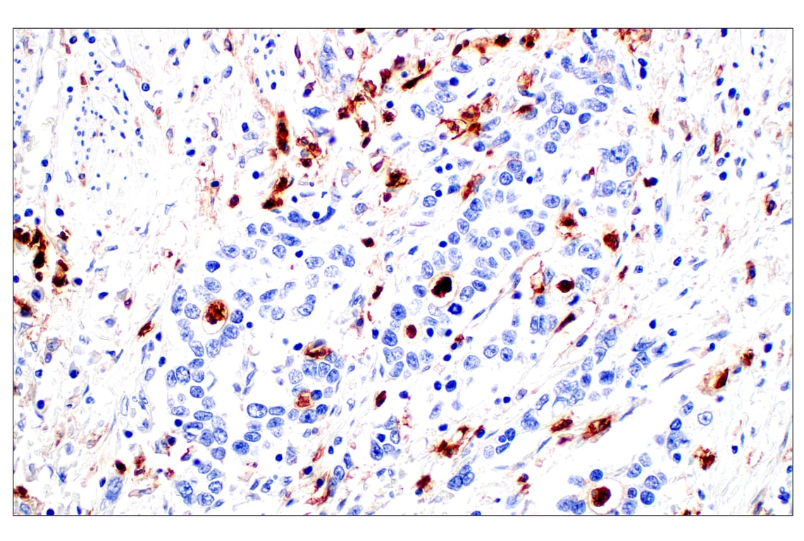 Immunohistochemistry Image 6: CD11b/ITGAM (E3J2F) Rabbit Monoclonal Antibody