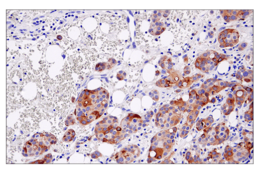 Immunohistochemistry Image 1: Cleaved Gasdermin D (Asp275) (E7H9G) Rabbit Monoclonal Antibody (BSA and Azide Free)