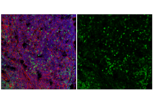 Immunofluorescence Image 2: CDK2 (E8J9T) Rabbit Monoclonal Antibody