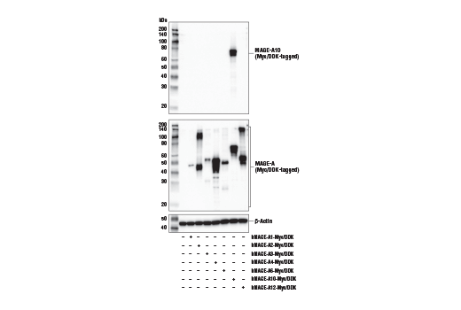 Western Blotting Image 2: MAGE-A10 (E9V2Q) Rabbit Monoclonal Antibody (BSA and Azide Free)
