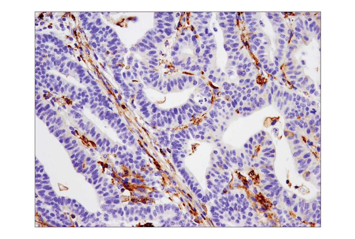 Immunohistochemistry Image 1: VISTA (D1L2G) Rabbit Monoclonal Antibody
