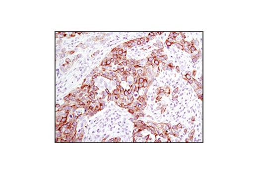 Immunohistochemistry Image 2: Keratin 17/19 (D32D9) Rabbit Monoclonal Antibody