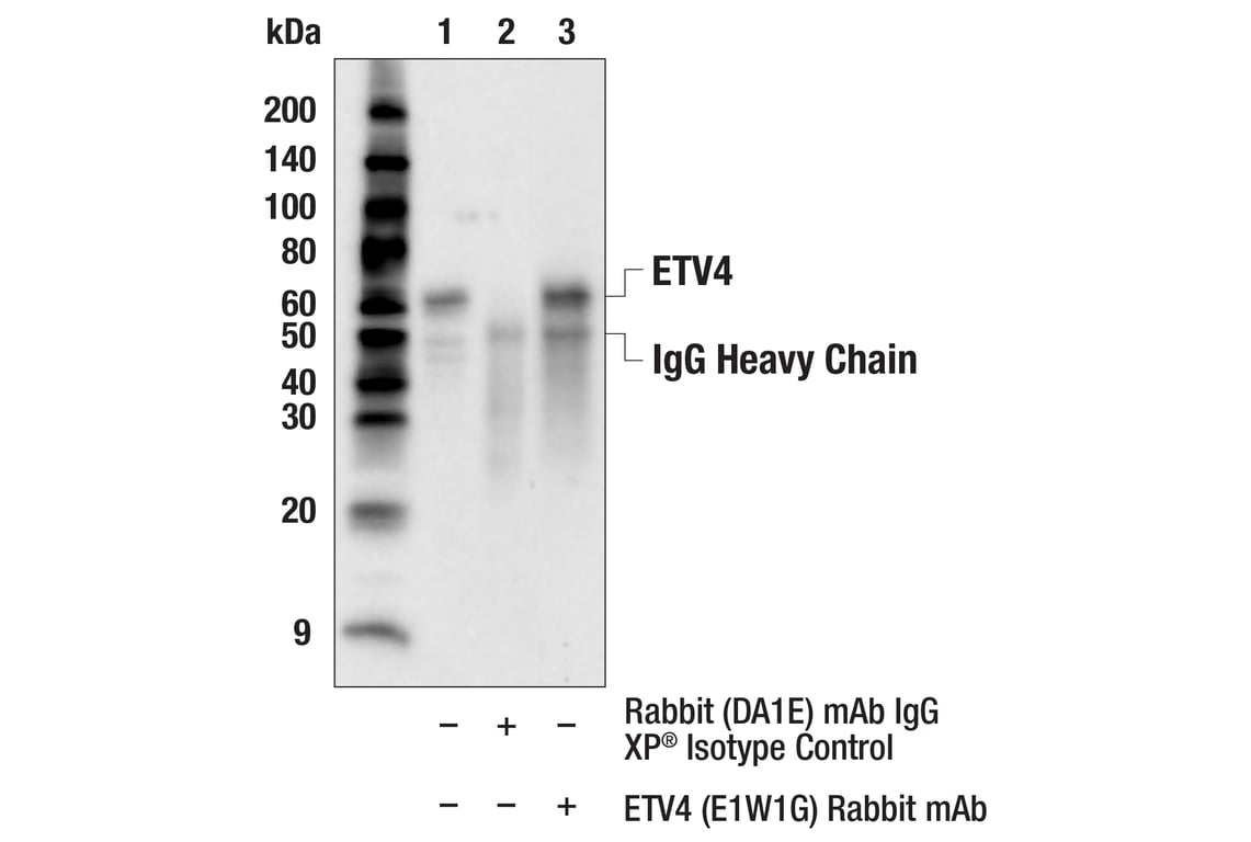 Immunoprecipitation Image 1: ETV4 (E1W1G) Rabbit Monoclonal Antibody