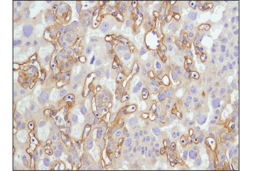 Immunohistochemistry Image 4: EGF Receptor (D1P9C) Rabbit Monoclonal Antibody (BSA and Azide Free)