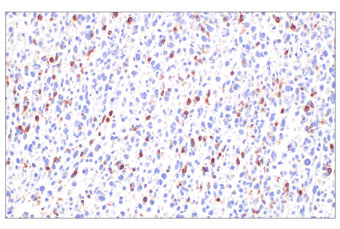 Immunohistochemistry Image 2: CD27 (F3R2V) Rabbit Monoclonal Antibody