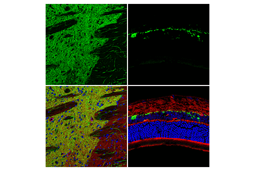 Immunofluorescence Image 1: Tyrosine Hydroxylase (LNC1) Mouse Monoclonal Antibody