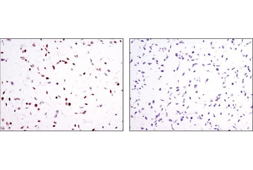 Immunohistochemistry Image 1: RAR gamma1 (D3A4) Rabbit Monoclonal Antibody