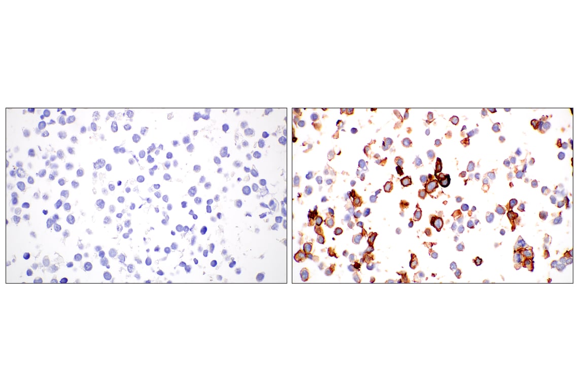 Immunohistochemistry Image 9: CD47 (E2V9V) Rabbit Monoclonal Antibody (BSA and Azide Free)