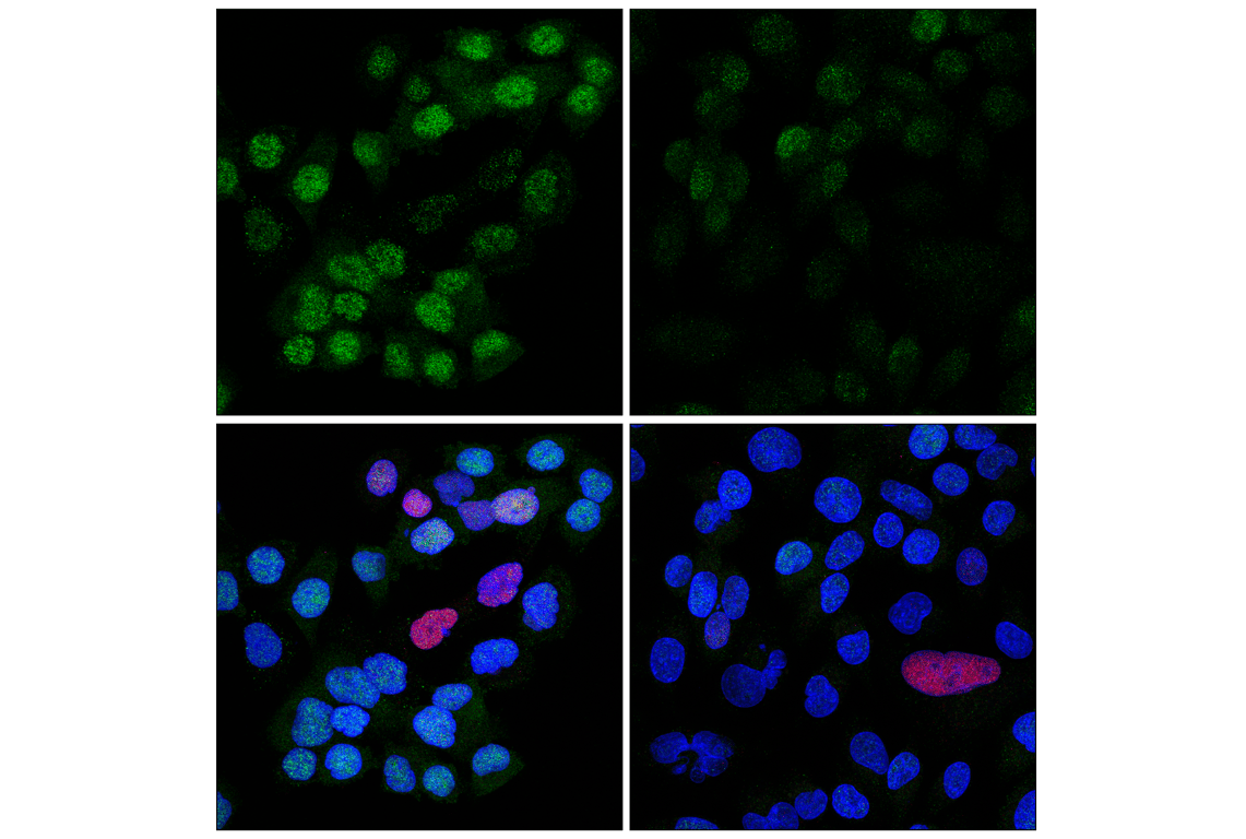 undefined Image 43: Phospho-Chk1/2 Antibody Sampler Kit