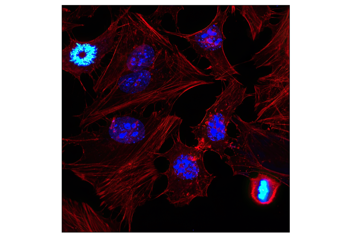 Immunofluorescence Image 1: Ki-67 (D3B5) Rabbit Monoclonal Antibody (Alexa Fluor<sup>®</sup> 647 Conjugate)