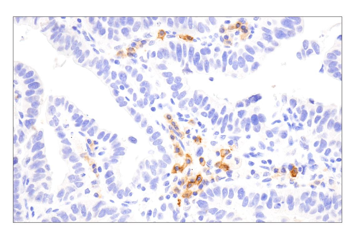 Immunohistochemistry Image 8: TNFRSF17/BCMA (E6D7B) Rabbit Monoclonal Antibody