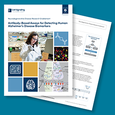 Reliable biomarkers are critical for early detection, diagnosis, prognosis, and evaluating the efficacy of potential new therapies. Discover how assay tools can advance your AD research.
