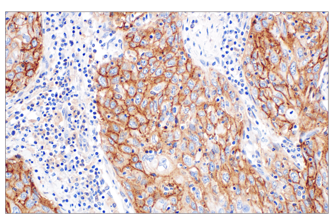 Immunohistochemistry Image 3: CD44 v5 (C44Mab-3) Mouse Monoclonal Antibody