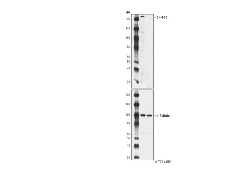 Western Blotting Image 1: Ch-TOG (D2Z8J) Rabbit mAb