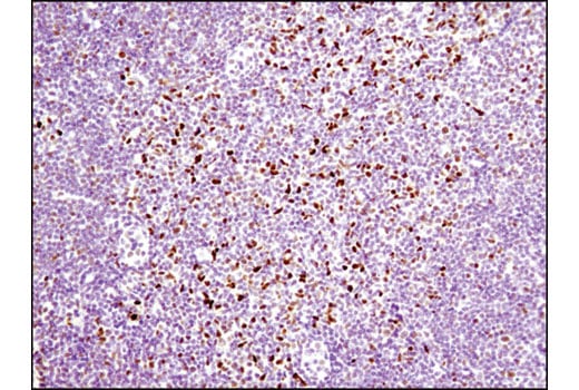 undefined Image 38: Notch Activated Targets Antibody Sampler Kit