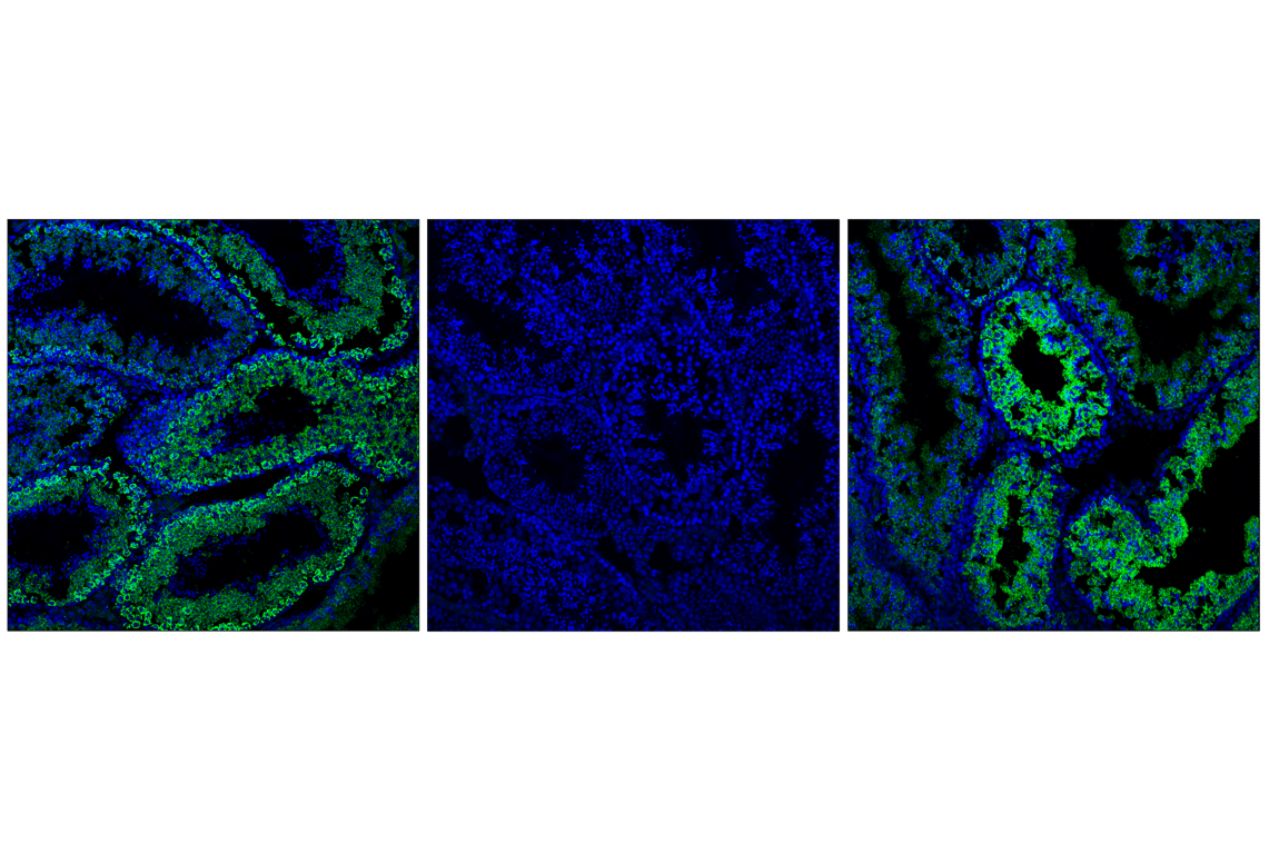 Immunofluorescence Image 1: Phospho-Pyruvate Dehydrogenase alpha1 (Ser293) (E4V9L) Rabbit Monoclonal Antibody