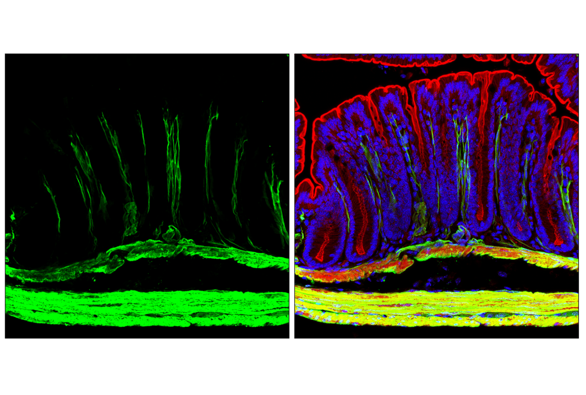 Immunofluorescence Image 3: Transgelin/TAGLN (F3B7H) Rabbit Monoclonal Antibody