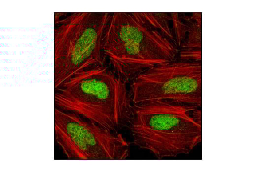 Immunofluorescence Image 1: Chk2 (1C12) Mouse Monoclonal Antibody