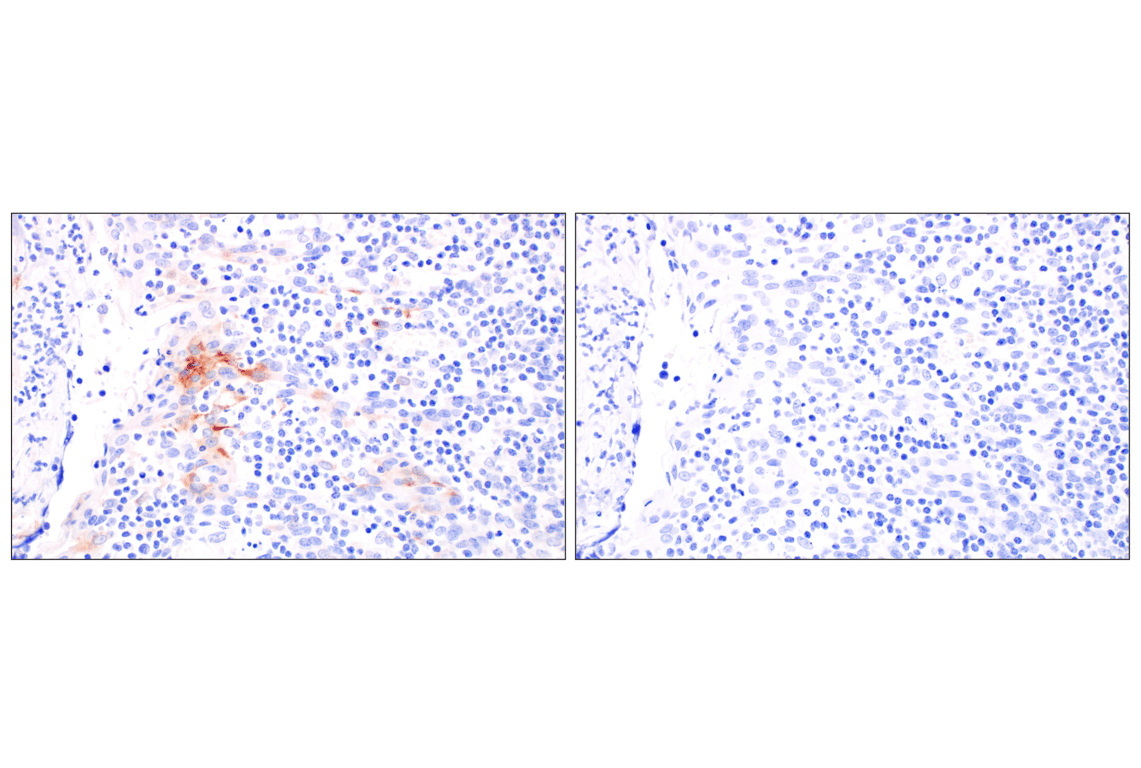 Immunohistochemistry Image 5: CXCL10 (F9N8I) Rabbit Monoclonal Antibody