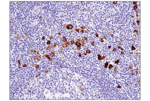 Immunohistochemistry Image 2: TNFRSF8/CD30 (E4L4I) Rabbit Monoclonal Antibody