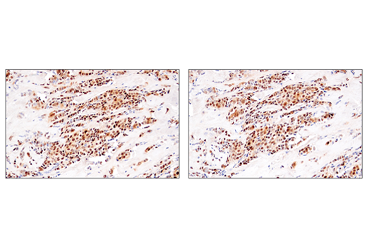 Immunohistochemistry Image 2: Cyclin D1 (E3P5S) Rabbit Monoclonal Antibody