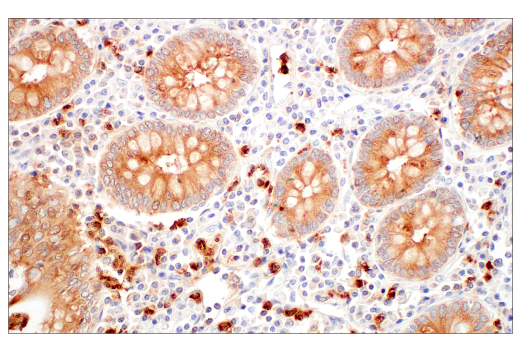 Immunohistochemistry Image 6: LCN2 (D4M8L) Rabbit Monoclonal Antibody