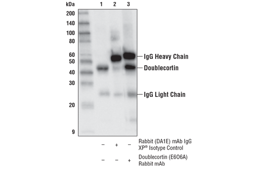 Immunoprecipitation Image 1: Doublecortin (E6O6A) Rabbit Monoclonal Antibody