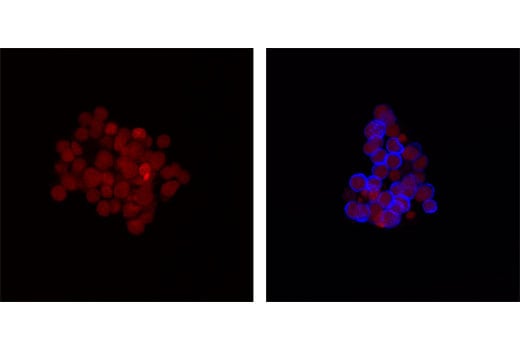 Immunofluorescence Image 1: Phospho-Syk (Tyr525/526) (C87C1) Rabbit mAb (Alexa Fluor<sup>®</sup> 647 Conjugate)