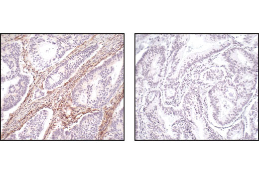 Immunohistochemistry Image 2: PTEN (138G6) Rabbit Monoclonal Antibody (BSA and Azide Free)