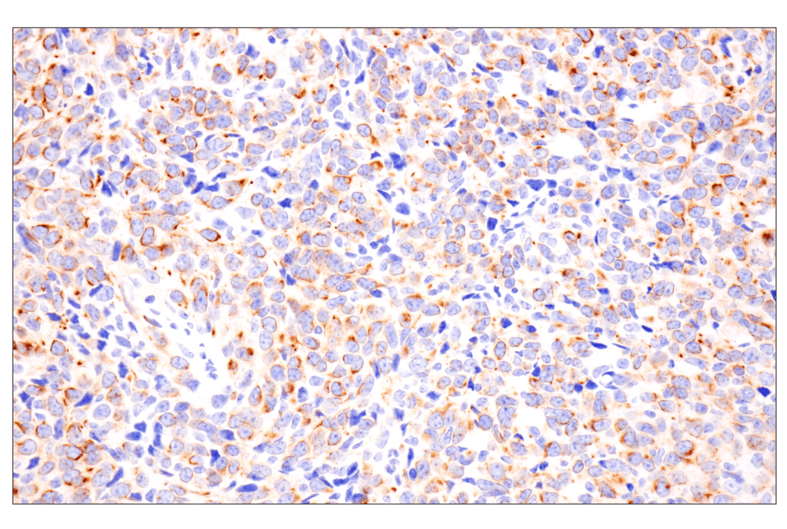 Immunohistochemistry Image 13: Pan-Keratin (Type II) (F6G1P) Rabbit Monoclonal Antibody