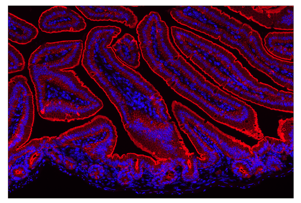 Immunohistochemistry Image 2: Pan-Keratin (Type I) (E6S1S) Rabbit Monoclonal Antibody (Alexa Fluor<sup>®</sup> 647 Conjugate)