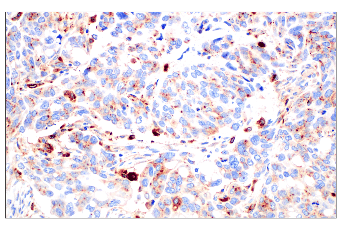 Cathepsin Z (F4M4S) Rabbit Monoclonal Antibody | Cell Signaling