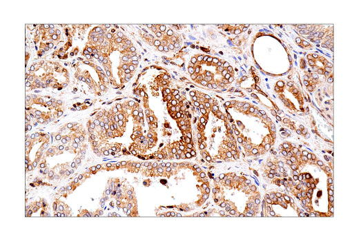 Immunohistochemistry Image 3: Tapasin (E6P2Z) Rabbit Monoclonal Antibody (BSA and Azide Free)