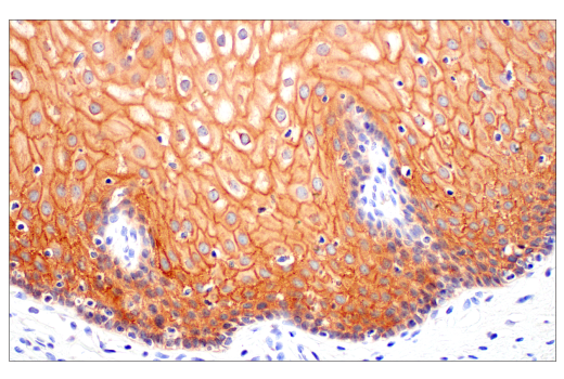 ZNF185 (E6W4I) Rabbit mAb | Cell Signaling Technology